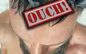 Finn Balor Shows Off Nasty Cut After WWE WrestleMania 39 Match