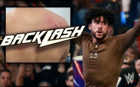 Bad Bunny Displays Gruesome Injuries After WWE Backlash Bad Bunny Displays Gruesome Injuries After WWE Backlash