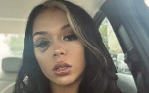 Cora Jade Shows Off Nasty Eye Wound Ahead of WWE NXT Cora Jade Shows Off Nasty Eye Wound Ahead of WWE NXT