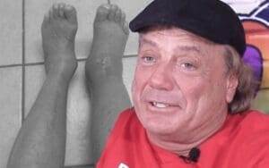 Marty Jannetty Posts Photo Of His Ankle After Surgery Marty Jannetty Posts Photo Of His Ankle After Surgery