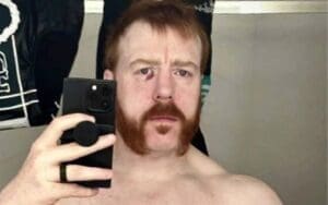 Sheamus Shows Off Nasty Battle Wounds After Recent WWE Live Event Sheamus Shows Off Nasty Battle Wounds After Recent WWE Live Event
