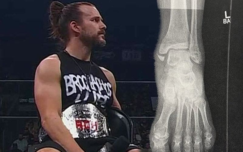 Adam Cole’s X-Ray Of Broken Ankle Is Hard To Look At