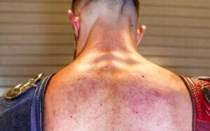 Finn Balor Shows Off Brutal Welts After WWE Payback