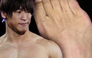 Kota Ibushi Shows Off Nasty Stitches After Ankle Surgery