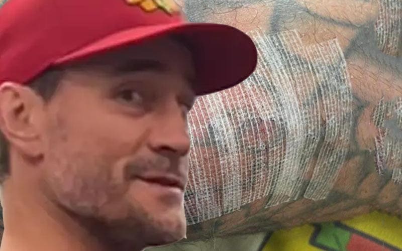 CM Punk Shows Off Injured Triceps Stitched Up Three Weeks Post Surgery
