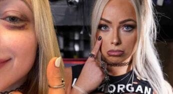 liv-morgan-sports-black-eye-after-competing-in-battle-royal-on-raw-40