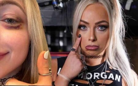 liv-morgan-sports-black-eye-after-competing-in-battle-royal-on-raw-40