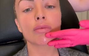 Ex-WWE Star Mandy Rose Recently Underwent Procedure to Reverse Cosmetic Surgery