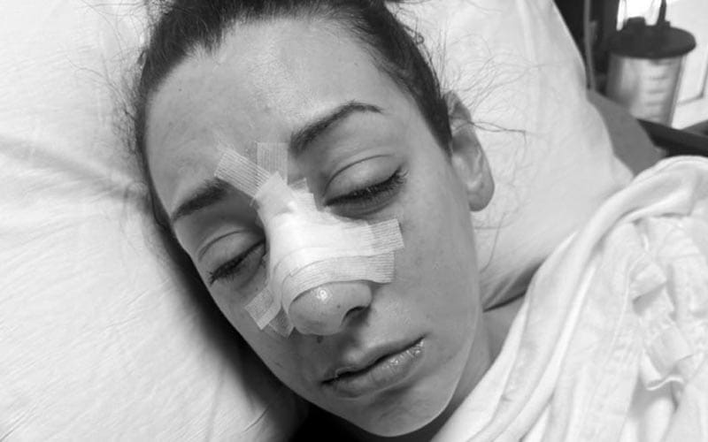 jacy-jayne-drops-photo-post-surgery-for-recent-nose-injury-28