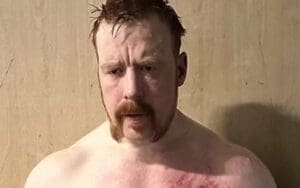 Sheamus Shows Off Battle Scars Following Intense Bout With Ludwig Kaiser on 6/3 WWE RAW