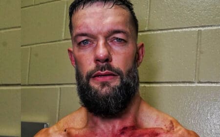 Finn Balor Shows Off Brutal Aftermath of GUNTHER's Offense After 7/29 WWE RAW