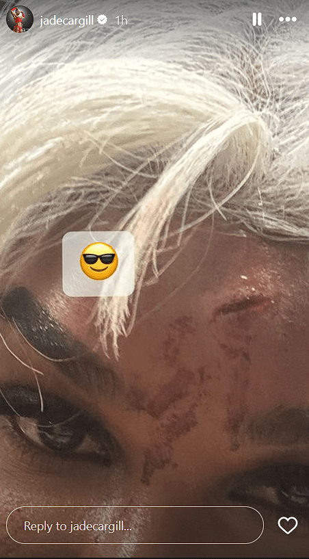 jade-cargill-shows-off-nasty-head-bruise-suffered-during-wwes-japan-tour-39