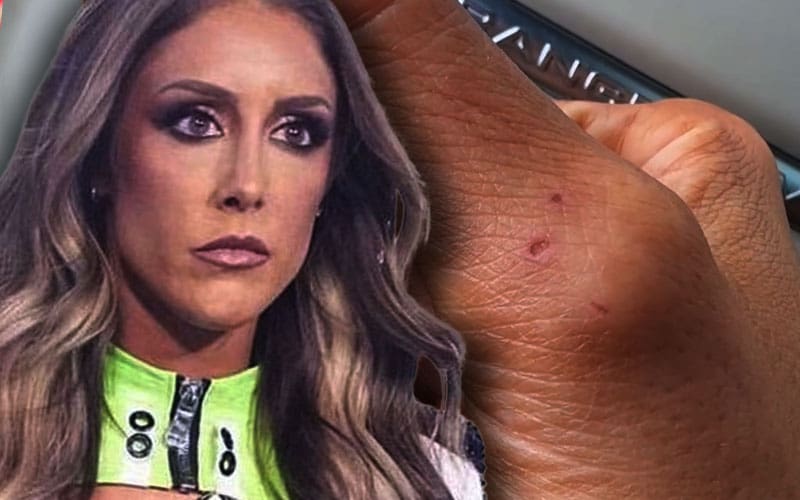 britt-baker-shows-off-bite-marks-left-by-mercedes-mone-after-intense-match-at-aew-all-in-09