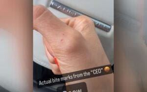 Britt Baker Shows Off Bite Marks Left By Mercedes Mone After Intense Match at AEW All-In