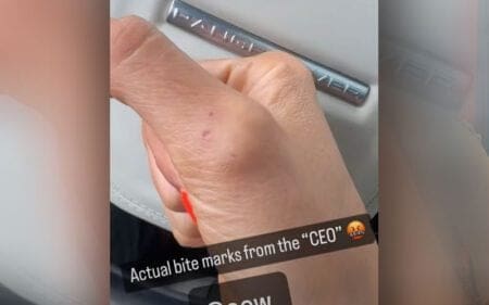 Britt Baker Shows Off Bite Marks Left By Mercedes Mone After Intense Match at AEW All-In Britt Baker Shows Off Bite Marks Left By Mercedes Mone After Intense Match at AEW All-In