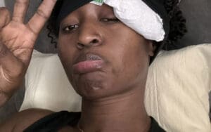 Queen Aminata Shows Off Nasty Injury Following 9/21 AEW Collision Match