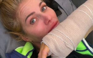 Torrie Wilson Underwent Successful Thumb Surgery Recently