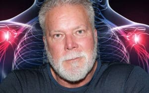 Kevin Nash Details Gruesome Bicep Tear and Upcoming Surgery