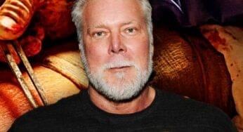 Kevin Nash Posts Gruesome Surgery Pic While Updating Fans on His Recovery Journey