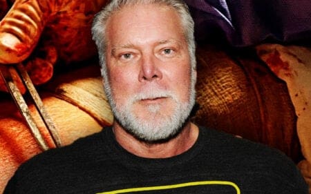 Kevin Nash Posts Gruesome Surgery Pic While Updating Fans on His Recovery Journey