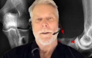 Kevin Nash Reveals Complications Following Bicep Surgery