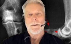 Kevin Nash Reveals Complications Following Bicep Surgery