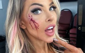 Natalia Markova Shows Off Battle Wounds After Brutal Cage Match at NWA Event Natalia Markova Shows Off Battle Wounds After Brutal Cage Match at NWA Event