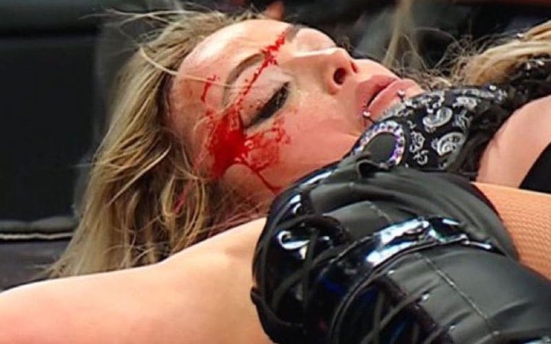 Liv Morgan’s Health Status After Bloody Injury on 2/10 WWE RAW