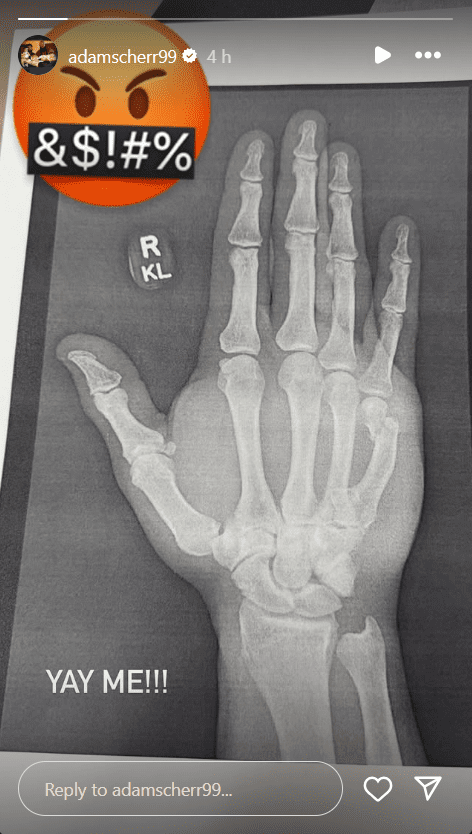 Ex-WWE Star Braun Strowman Confirms Injury with Graphic X-Ray