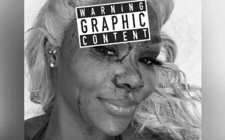 Jade Cargill Shows Off Graphic Bloody Cut After WWE SmackDown Jade Cargill Shows Off Graphic Bloody Cut After WWE SmackDown