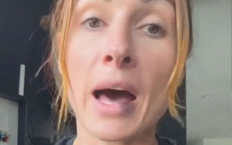 Becky Lynch Blames Maxxine’s Nails for Causing ‘Intense Damage’ During 10/20 WWE RAW Becky Lynch Blames Maxxine’s Nails for Causing ‘Intense Damage’ During 10/20 WWE RAW