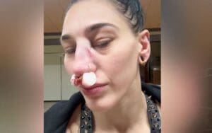 Rhea Ripley Bloodied During WWE Match in Japan After Brutal Mid-Ring Collision