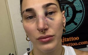 Rhea Ripley Shows Off Broken Nose After Brutal WWE Match in Japan Rhea Ripley Shows Off Broken Nose After Brutal WWE Match in Japan