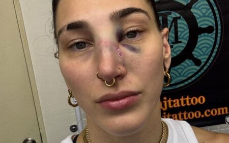 Rhea Ripley Shows Off Broken Nose After Brutal WWE Match in Japan