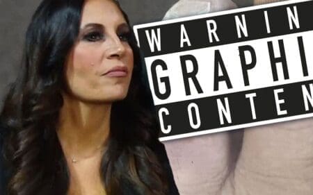 ECW Legend Francine Shows Off Incredibly Gruesome Broken Toe Injury
