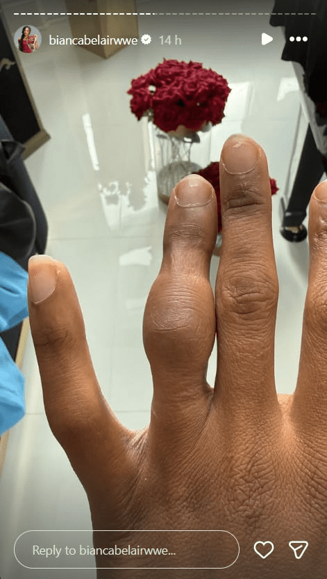 Positive Update on Bianca Belair's Recovery After Brutal WrestleMania Injury