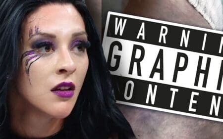 Stephanie Vaquer Shows Off Nasty Ankle Injury After WWE RAW Attack Stephanie Vaquer Shows Off Nasty Ankle Injury After WWE RAW Attack