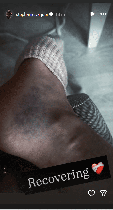 Stephanie Vaquer Shows Off Nasty Ankle Injury After WWE RAW Attack